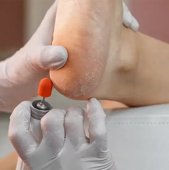Nasır Bakımı Nasır Bakımı